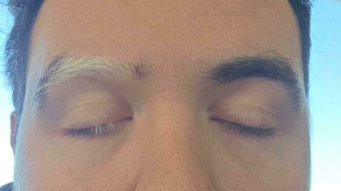 75 People With Physical Features So Rare They Almost Don&rsquo;t Look Real