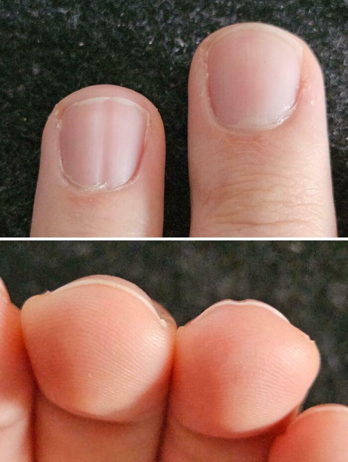 75 People With Physical Features So Rare They Almost Don&rsquo;t Look Real