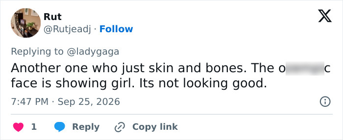Lady Gaga’s Latest Video Draws Brutal Comparisons To Ariana Grande Amid Concerns Over Her Appearance
