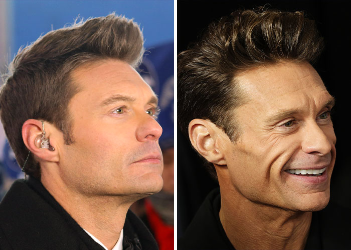 Ryan Seacrest’s Dramatic Transformation Under Intense Scrutiny As Fans Say He Looks Like A ‘Plastic Man’ Ryan Seacrest’s Dramatic Transformation Under Intense Scrutiny As Fans Say He Looks Like A ‘Plastic Man’