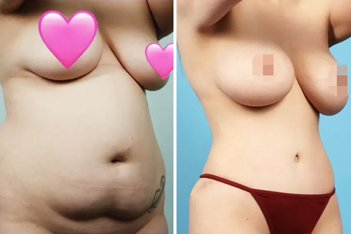 32YO Woman’s Innocent Photo With Her Husband Goes Viral For Totally Unexpected Reason 32YO Woman’s Innocent Photo With Her Husband Goes Viral For Totally Unexpected Reason