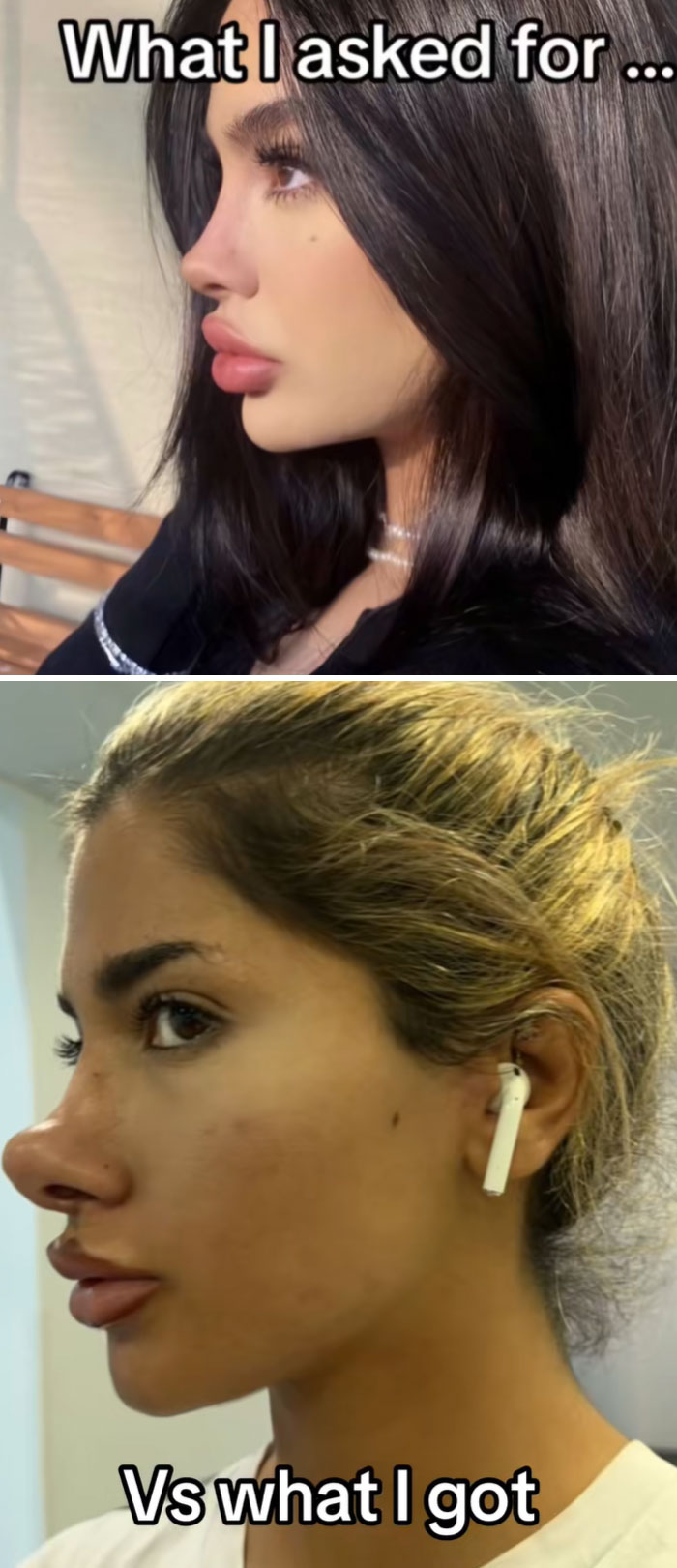 64 People Share The Beauty Procedures They Wish They Could Take Back