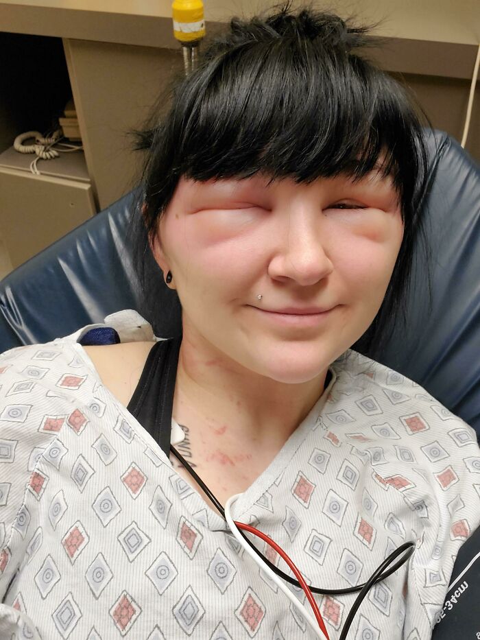 64 People Share The Beauty Procedures They Wish They Could Take Back