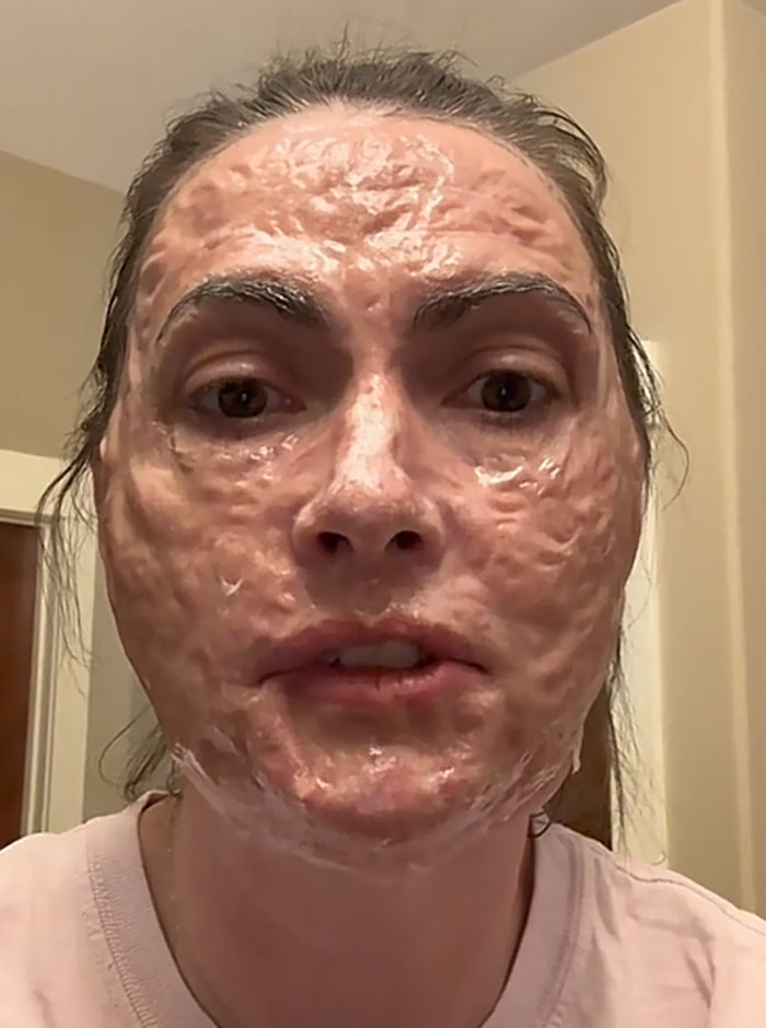 64 People Share The Beauty Procedures They Wish They Could Take Back