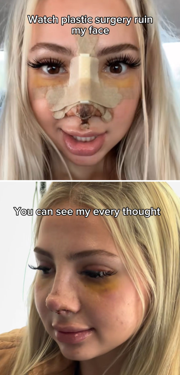 64 People Share The Beauty Procedures They Wish They Could Take Back