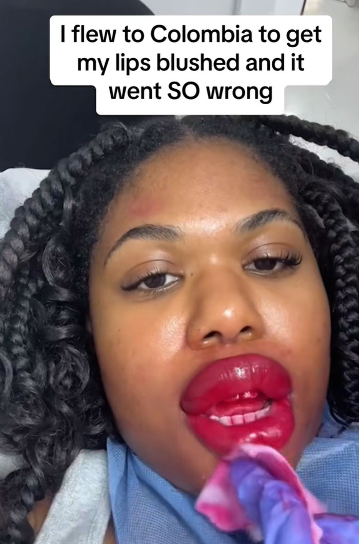 64 People Share The Beauty Procedures They Wish They Could Take Back