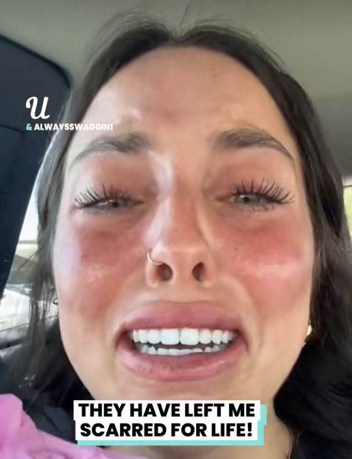 64 People Share The Beauty Procedures They Wish They Could Take Back