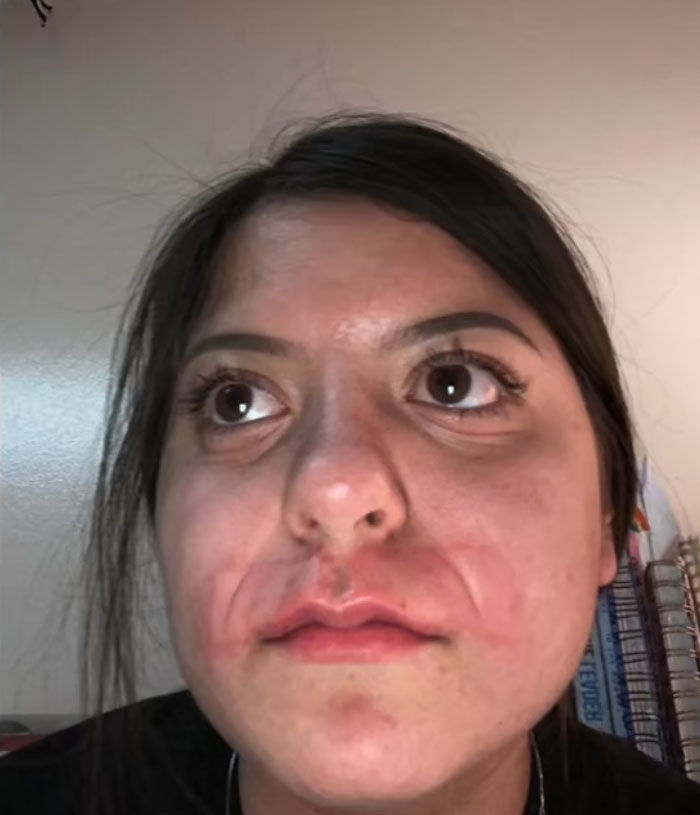 64 People Share The Beauty Procedures They Wish They Could Take Back