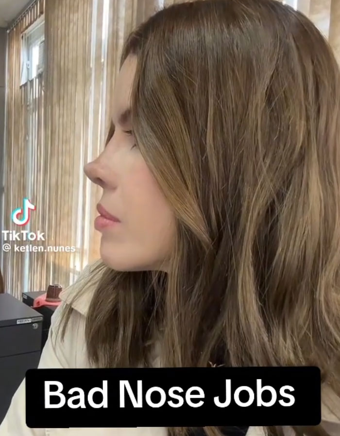 64 People Share The Beauty Procedures They Wish They Could Take Back