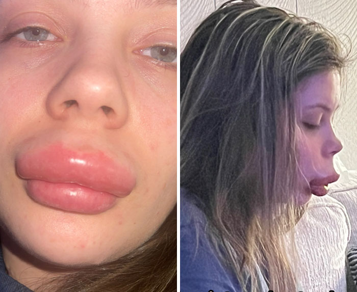 64 People Share The Beauty Procedures They Wish They Could Take Back