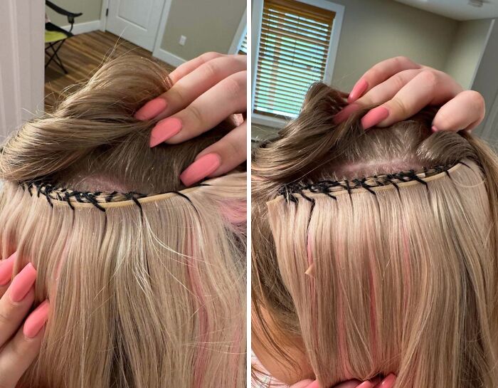 64 People Share The Beauty Procedures They Wish They Could Take Back