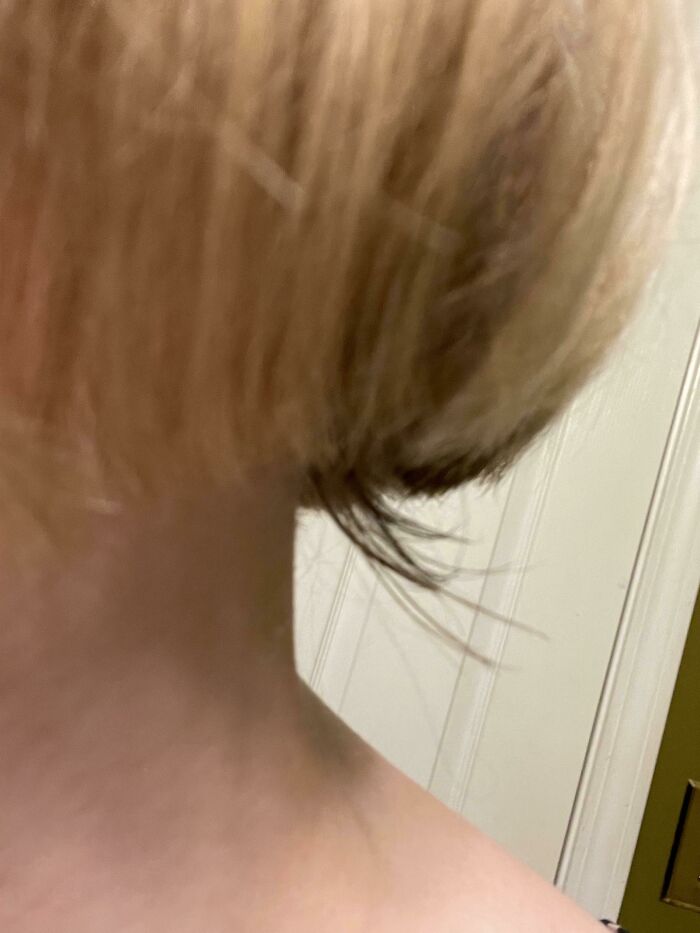 64 People Share The Beauty Procedures They Wish They Could Take Back