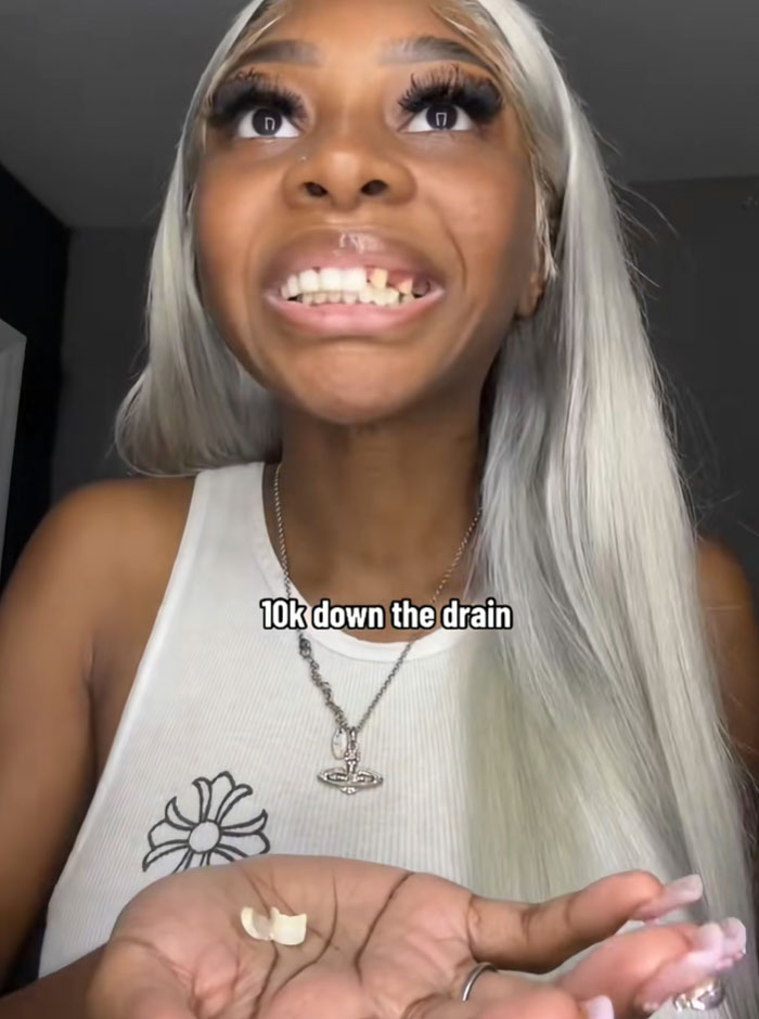 64 People Share The Beauty Procedures They Wish They Could Take Back
