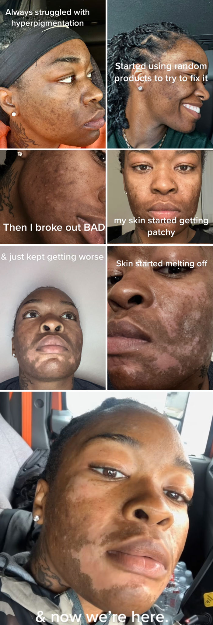 64 People Share The Beauty Procedures They Wish They Could Take Back