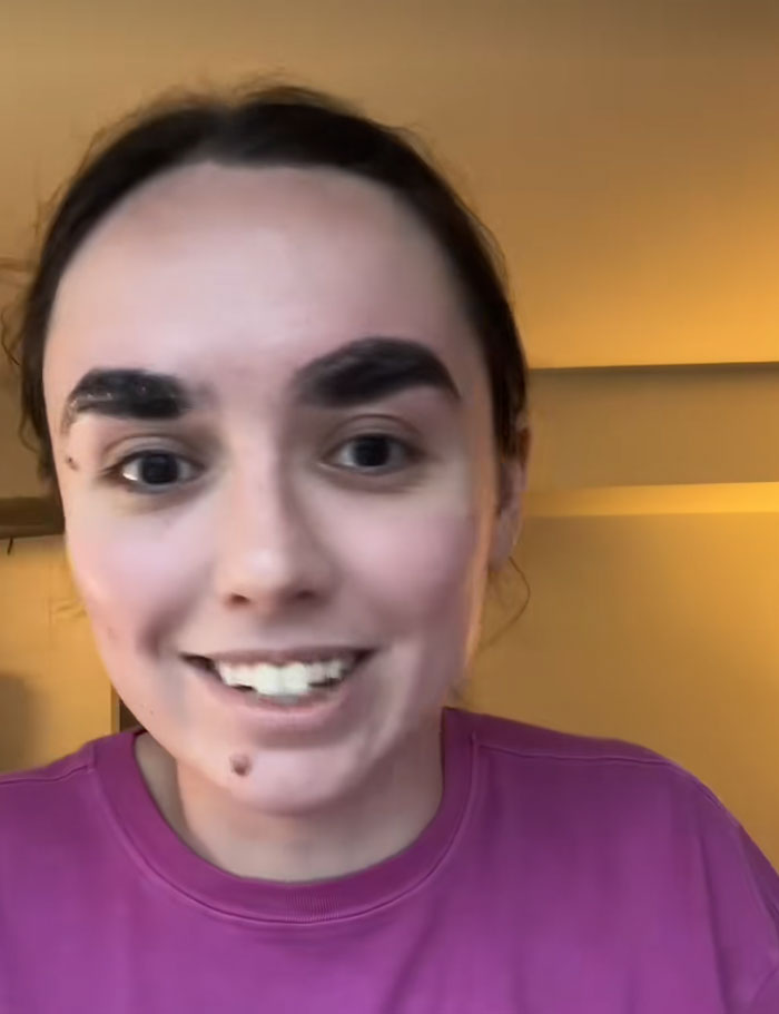 64 People Share The Beauty Procedures They Wish They Could Take Back