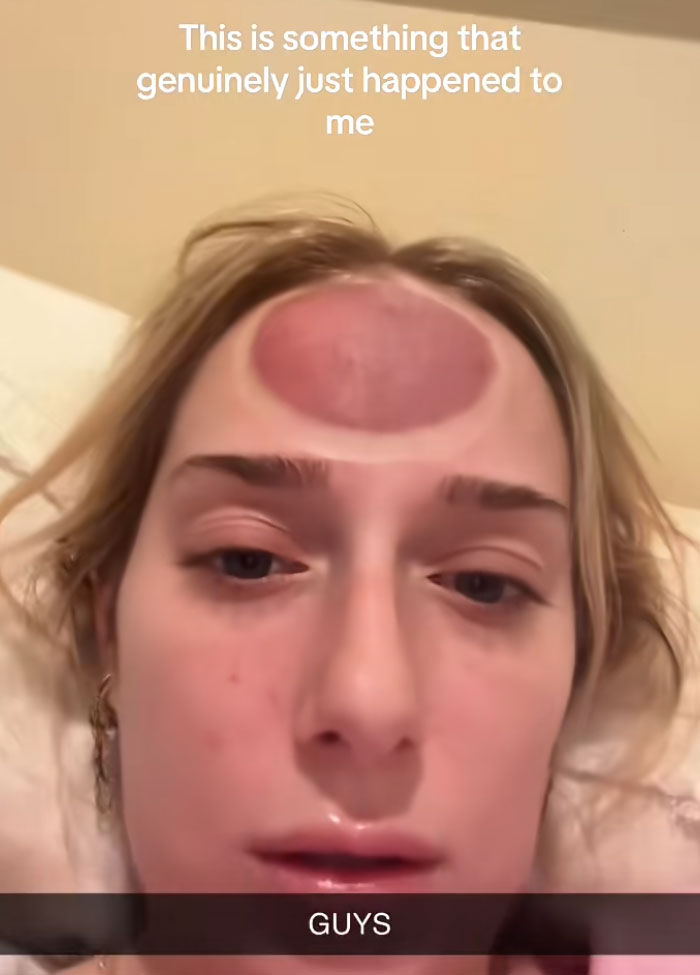 64 People Share The Beauty Procedures They Wish They Could Take Back