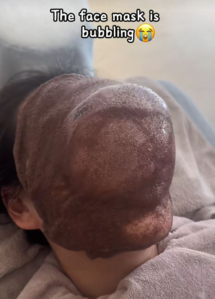 64 People Share The Beauty Procedures They Wish They Could Take Back