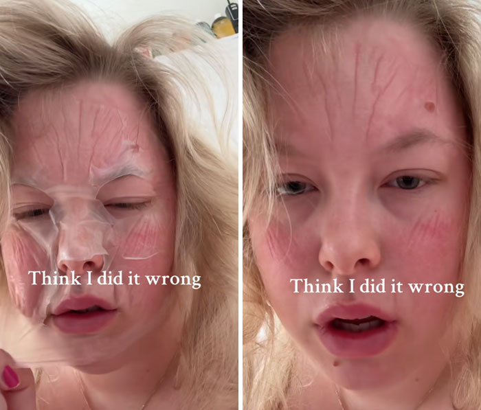 64 People Share The Beauty Procedures They Wish They Could Take Back