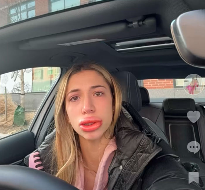 64 People Share The Beauty Procedures They Wish They Could Take Back