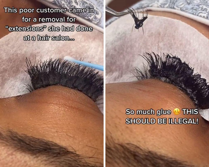 64 People Share The Beauty Procedures They Wish They Could Take Back