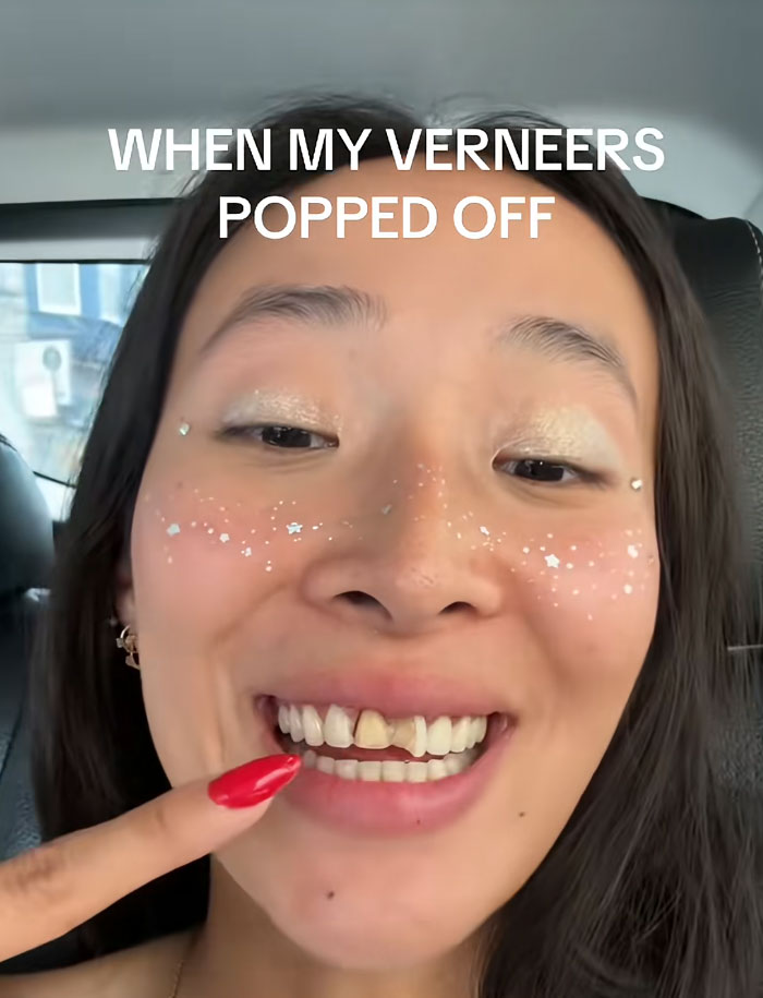 64 People Share The Beauty Procedures They Wish They Could Take Back