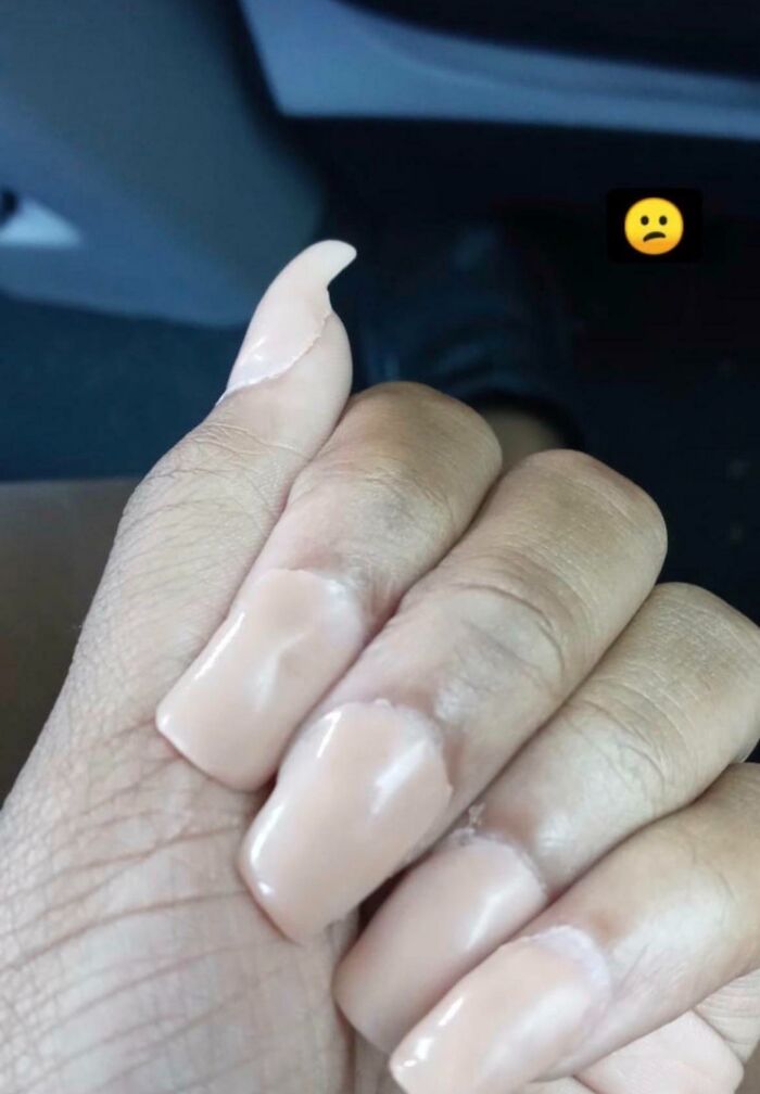 64 People Share The Beauty Procedures They Wish They Could Take Back