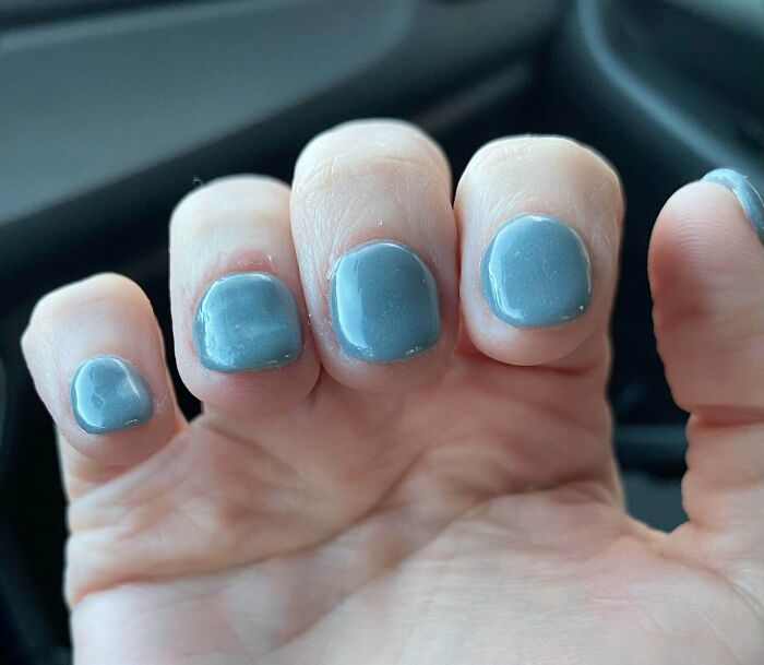 64 People Share The Beauty Procedures They Wish They Could Take Back