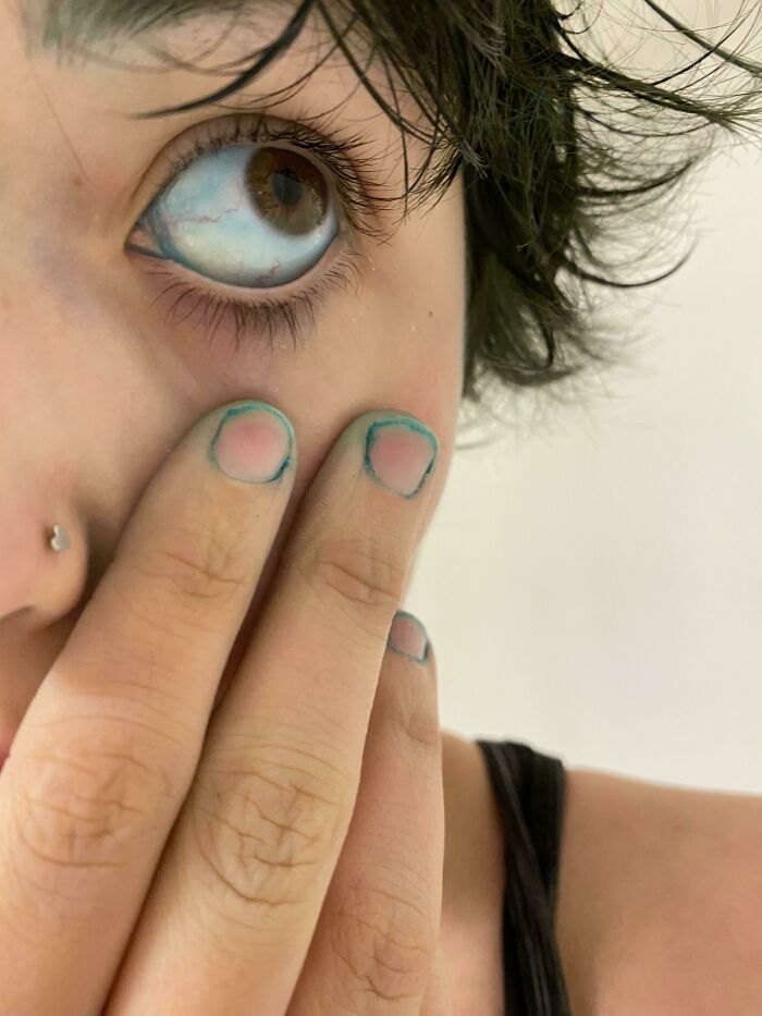 64 People Share The Beauty Procedures They Wish They Could Take Back