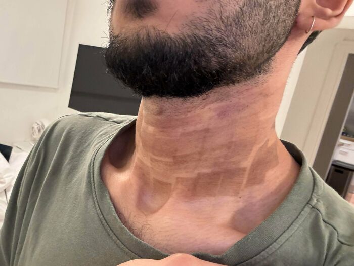 64 People Share The Beauty Procedures They Wish They Could Take Back