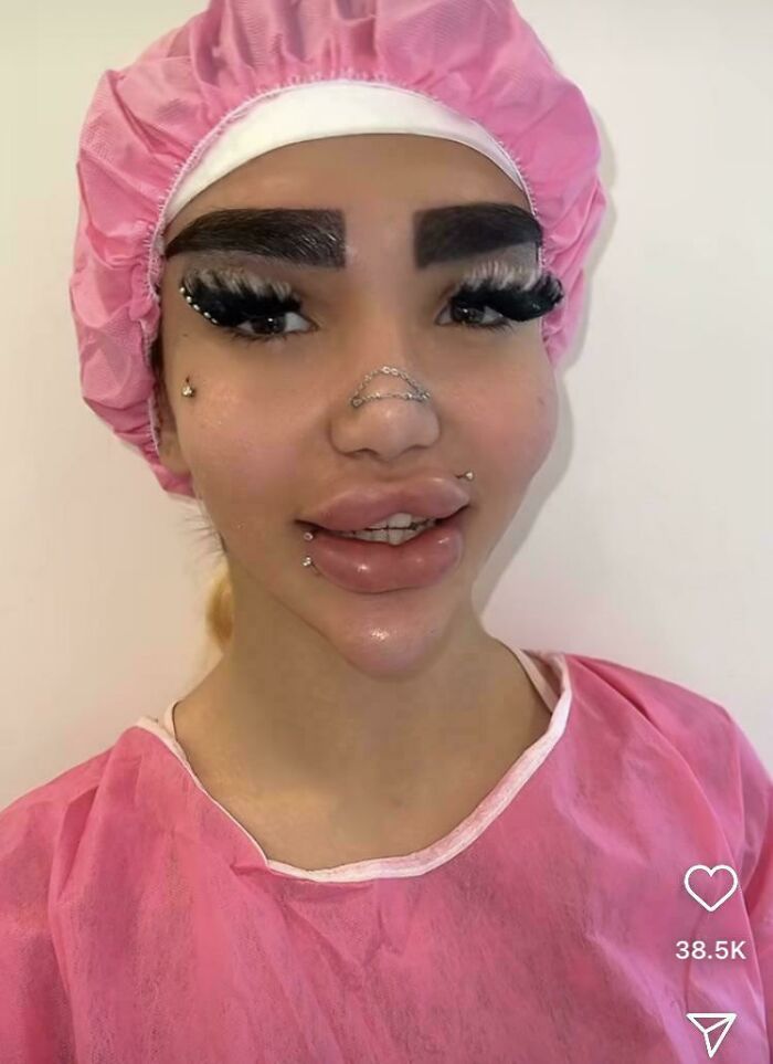 64 People Share The Beauty Procedures They Wish They Could Take Back