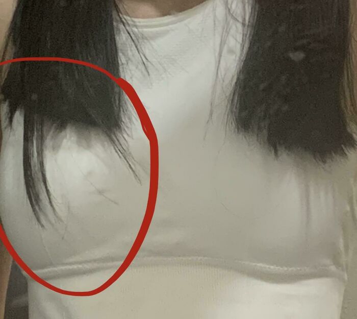 64 People Share The Beauty Procedures They Wish They Could Take Back