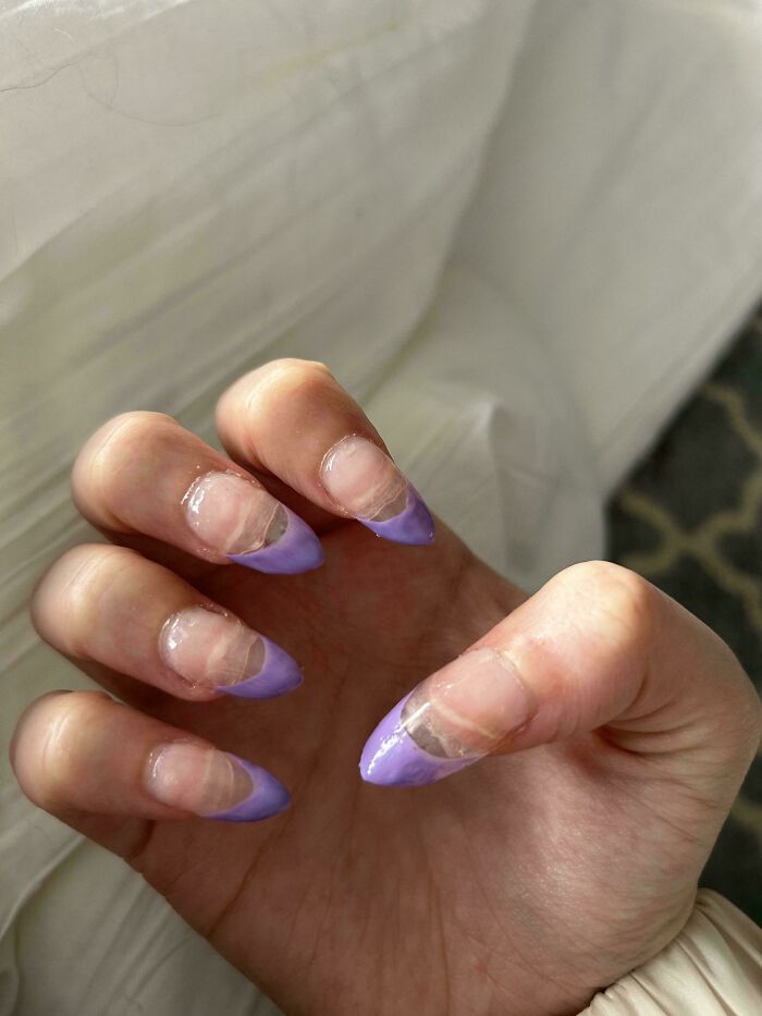 64 People Share The Beauty Procedures They Wish They Could Take Back