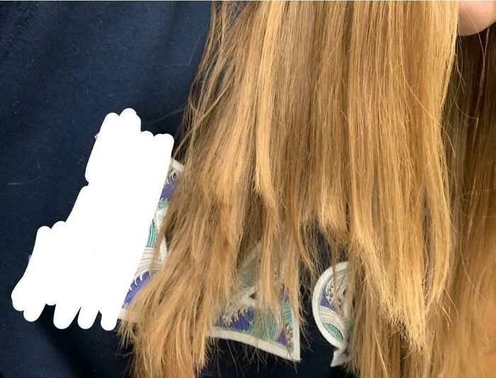 64 People Share The Beauty Procedures They Wish They Could Take Back