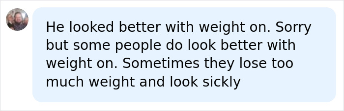 Doctor Weighs In After Hollywood Veteran’s Dramatic Weight Loss Has Everyone Making The Same Observation