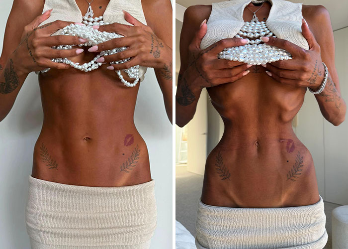 Influencer Gives Details On Bone-Breaking Plastic Surgery As Doctor Issues Urgent Warning Influencer Gives Details On Bone-Breaking Plastic Surgery As Doctor Issues Urgent Warning