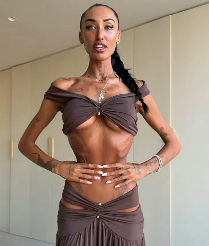 Influencer Gives Details On Bone-Breaking Plastic Surgery As Doctor Issues Urgent Warning Influencer Gives Details On Bone-Breaking Plastic Surgery As Doctor Issues Urgent Warning