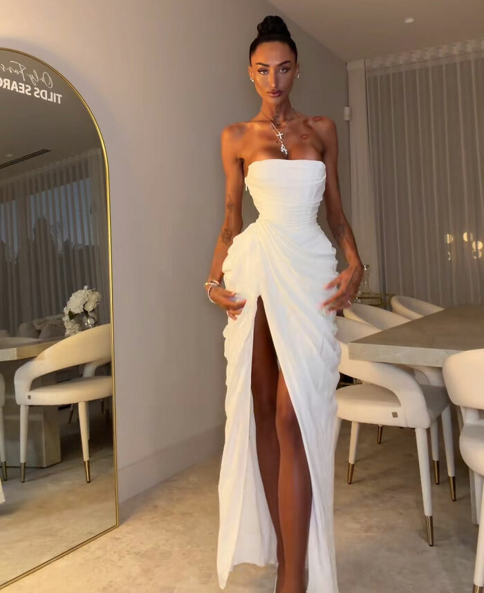Influencer Gives Details On Bone-Breaking Plastic Surgery As Doctor Issues Urgent Warning Influencer Gives Details On Bone-Breaking Plastic Surgery As Doctor Issues Urgent Warning
