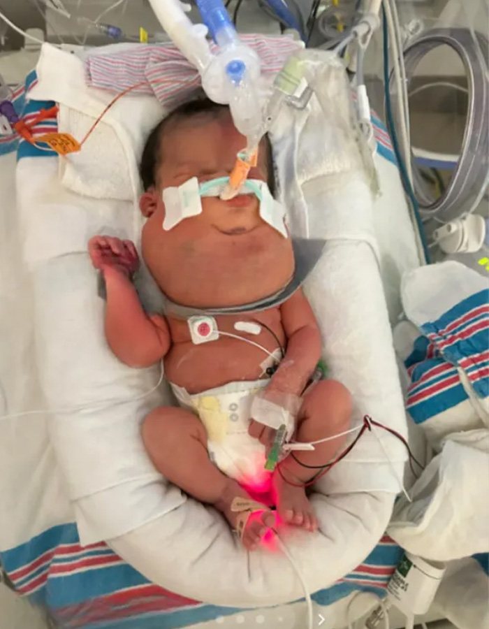 Pregnant Woman Goes For Routine Scan, Then Hears A Terrifying Two-Word Diagnosis