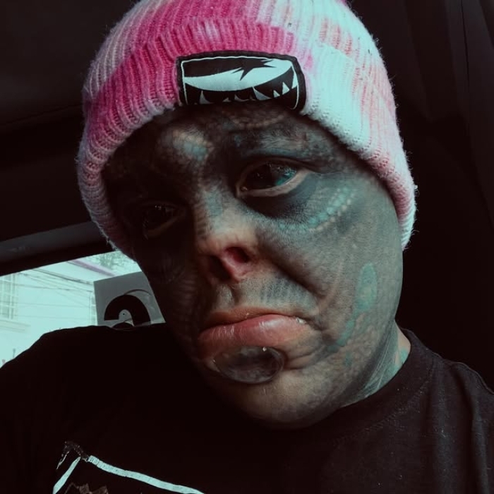 Man Undergoes Extreme Body Modifications&mdash;Including Cutting His Fingers And Nose&mdash;To Become &ldquo;The Amphibian Man&rdquo;