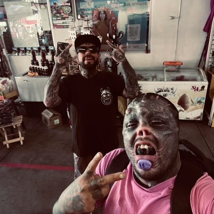 Man Undergoes Extreme Body Modifications&mdash;Including Cutting His Fingers And Nose&mdash;To Become &ldquo;The Amphibian Man&rdquo;