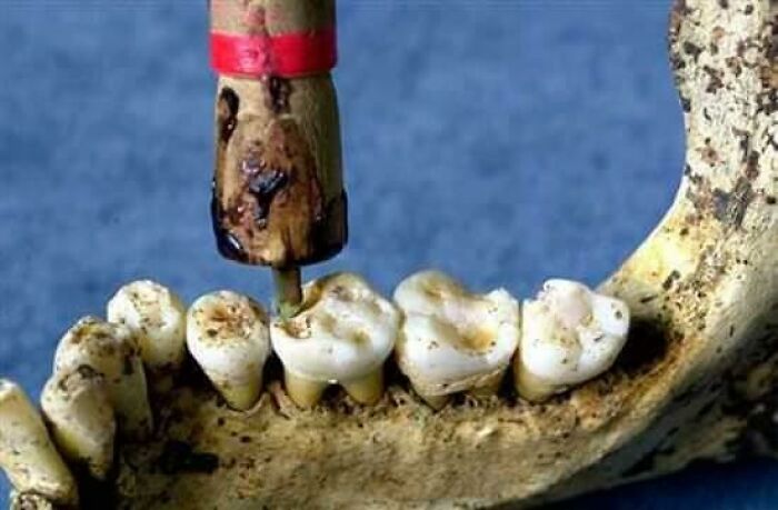 40 Fascinating Medical History Stories That Reveal How Much Medicine Has Changed 40 Fascinating Medical History Stories That Reveal How Much Medicine Has Changed