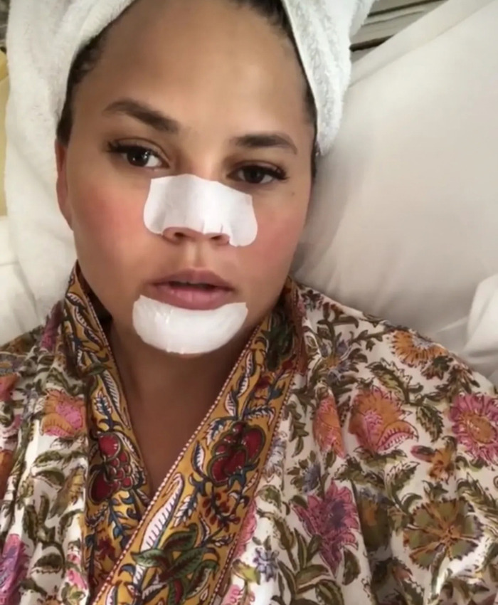 Dermatologist Warns Squeezing Black Spots On Your Nose Is A Serious Mistake Because They’re Not What You Think Dermatologist Warns Squeezing Black Spots On Your Nose Is A Serious Mistake Because They’re Not What You Think