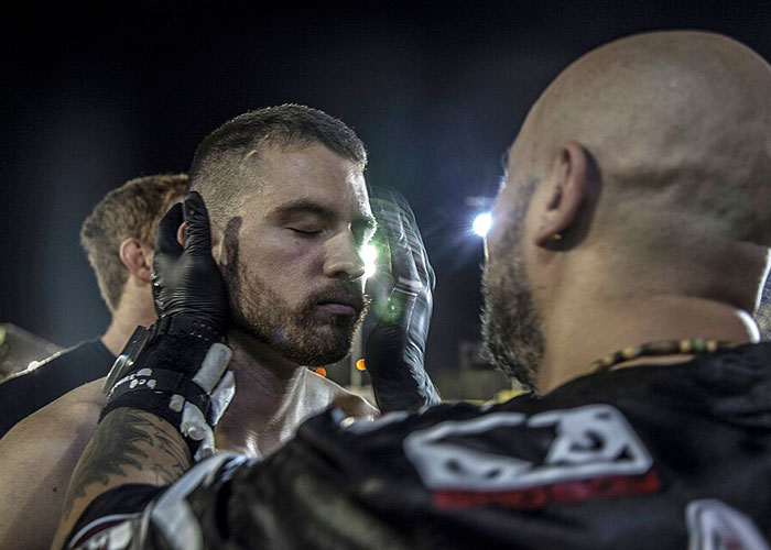 Men Who&rsquo;ve Never Been In The Ring Are Paying To Get “Cauliflower Ears” And Look Tougher