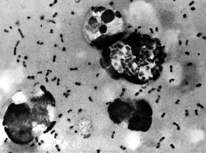 As Russian Plague Headlines Spread, Social Media Users Waste No Time Turning Them Into Dark Humor-Fueled Memes As Russian Plague Headlines Spread, Social Media Users Waste No Time Turning Them Into Dark Humor-Fueled Memes