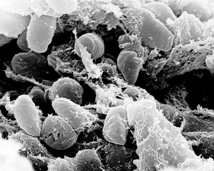 Mother Of Scientist Who Lost Life In Suspected Plague Lab Leak Speaks Out Against Official Story