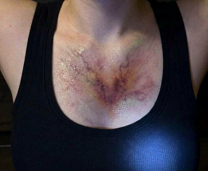 73 Absolutely Terrible Tattoos That Are Unfortunately Permanent (New Pics)