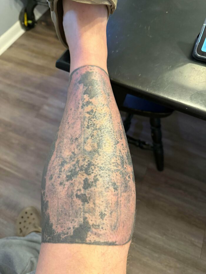 73 Absolutely Terrible Tattoos That Are Unfortunately Permanent (New Pics)
