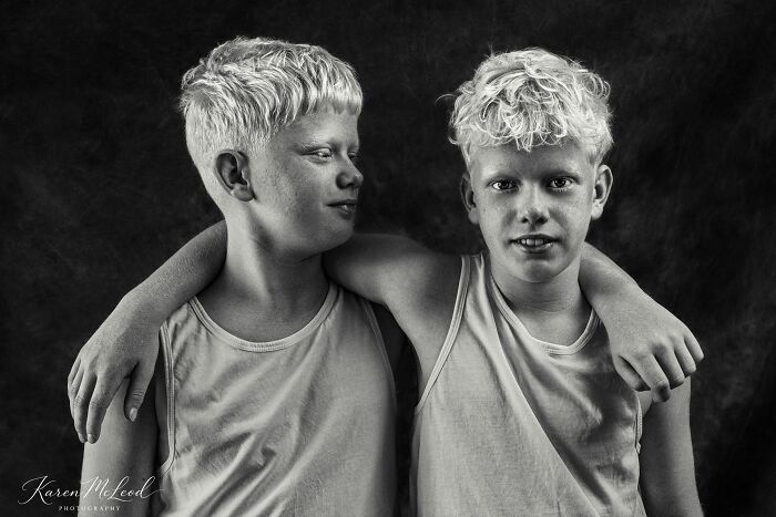 25 Portrait Photos Awarded By The Artist Gallery That Capture The Beauty Of Human Expression
