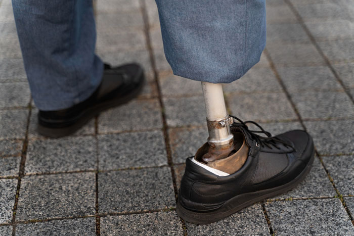 Feisty 80-Year-Old Amputee Chases Off A Man Who Wanted Her Wheelchair In The Most Hilarious Way