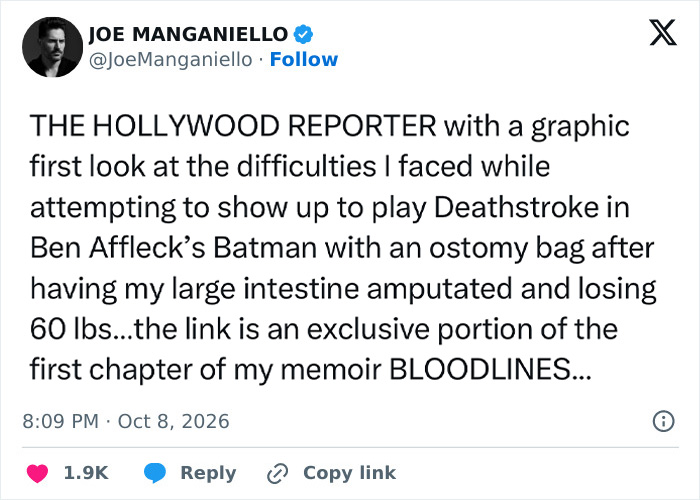 Joe Manganiello Shares Graphic Details Of Struggles After Major Amputation Amid Life-Threatening Health Battle